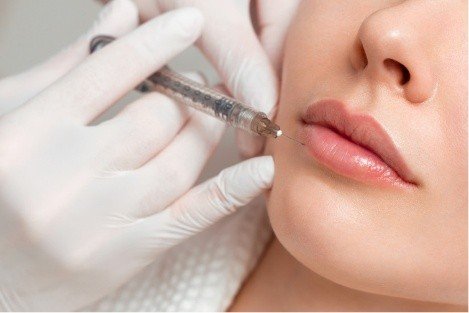 Zvětšení rtů: jak postupovat, abyste při zvětšení rtů dosáhli přirozeného výsledku? Zvětšení rtů: jak postupovat, abyste při zvětšení rtů dosáhli přirozeného výsledku?