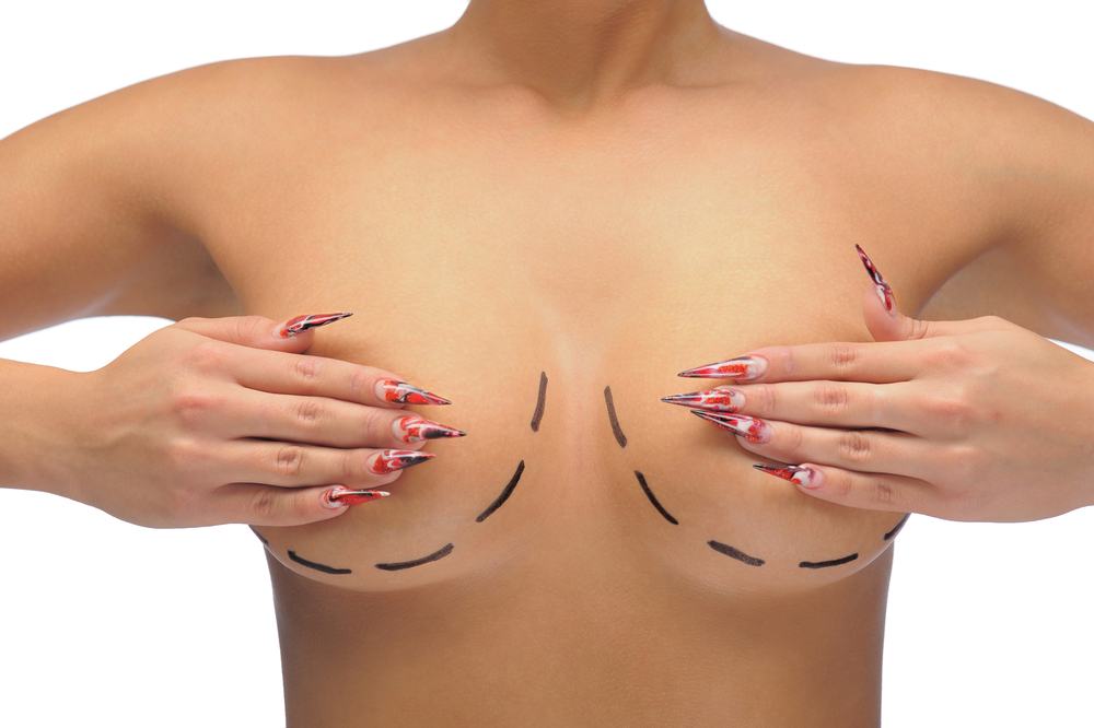 Uvažujete o zvětšení prsou? Dočtěte se více nejen o anatomických a kulatých implantátech