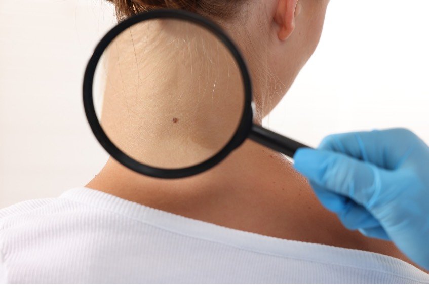 Odstranění znaménka